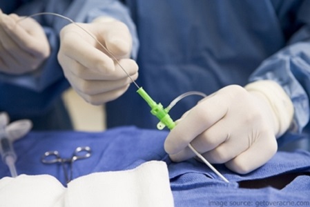 درمان دیسک با لیزر بدون جراحی باز 