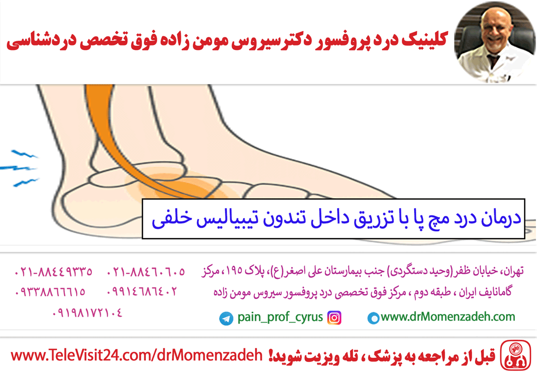 درمان درد مچ پا با تزریق داخل تندون تیبیالیس خلفی (Posterior Tibiais)