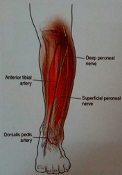 درمان درد مچ پا با استفاده از بلاک عصب پرونئال سطحی