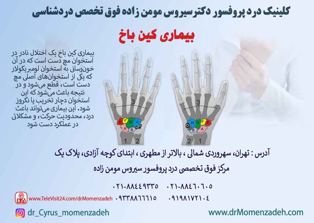 بیماری کین باخ (Kienböck’s Disease)