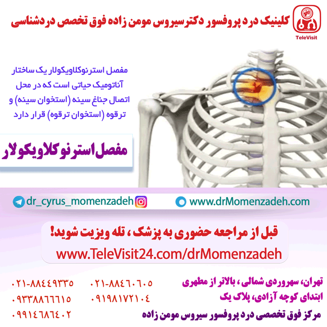 مفصل استرنوکلاویکولار