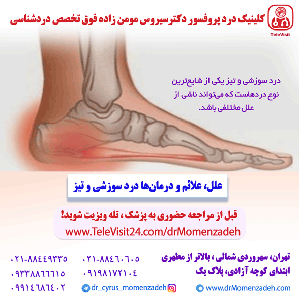 علل، علائم و درمان‌ها درد سوزشی و تیز،مدیتیشن،عضلات ،مصرف مواد مغذی،فیزیوتراپی 