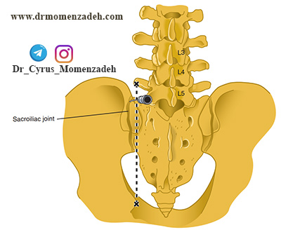 مفصل ساکروایلیاک