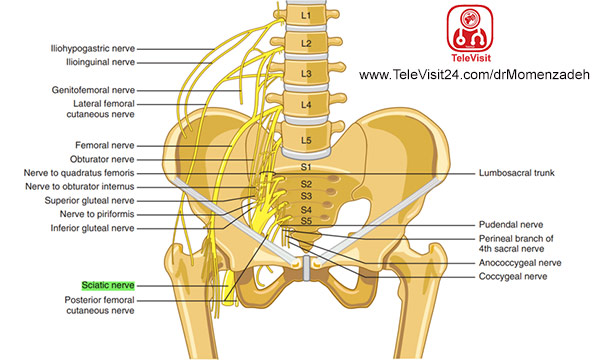 درد سیاتیک, درد پا, درد ران پا, دردباسن, درد بدن