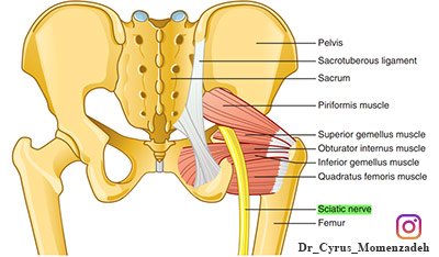درد سیاتیک, درد پا, درد ران پا, دردباسن, درد بدن
